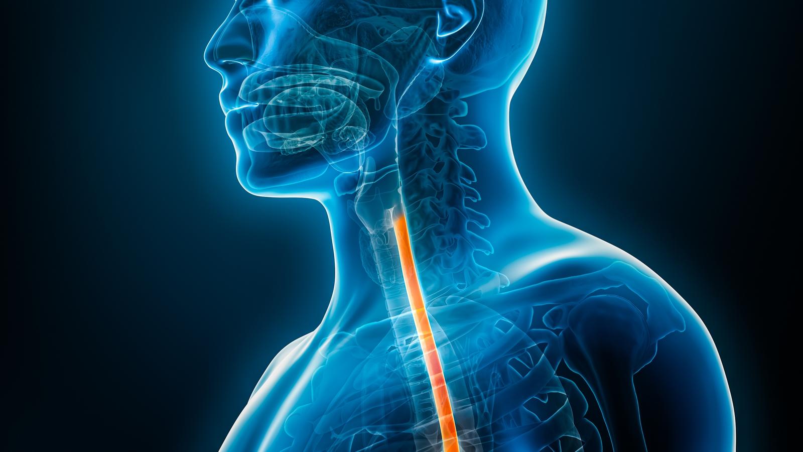 Menschliche Grafik von einem Röntgen mit Speisröhre gelb markiert