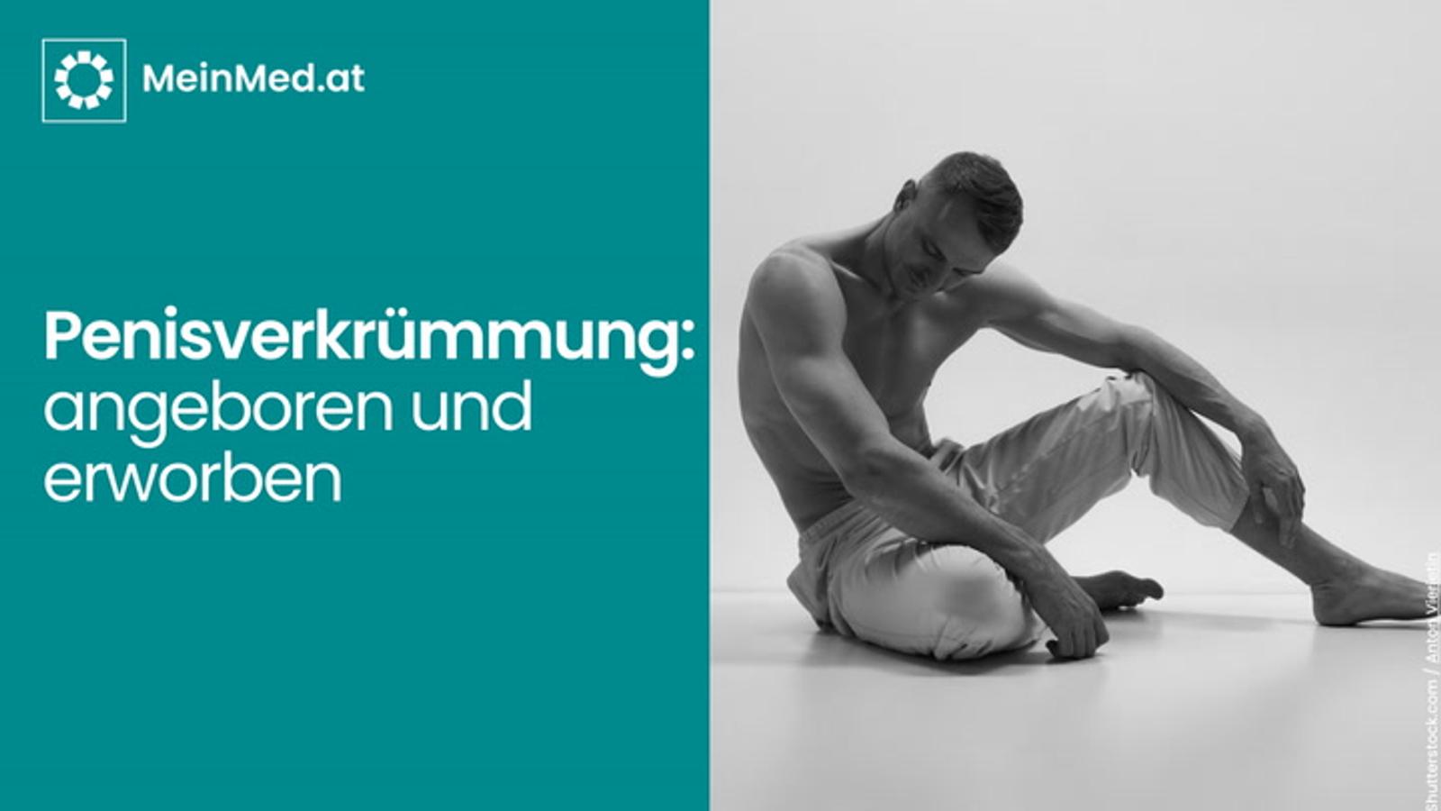 Penisverkrümmung: angeboren und erworben